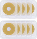 Moldable Ostomy Rings 10PCS O494